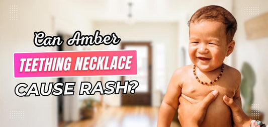 Can Amber Teething Necklace Cause Rash?